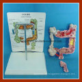 Vivid Colon und Rectum Common Disease Modell